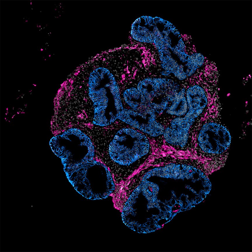 Startup Develops Miniature Human Intestines to Test Drugs Instead of Animal Models