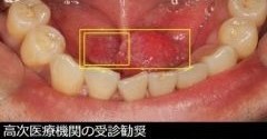 نظام Mucosight AI يحلل صور أمراض العين خلال 30 ثانية بدعم من NVIDIA