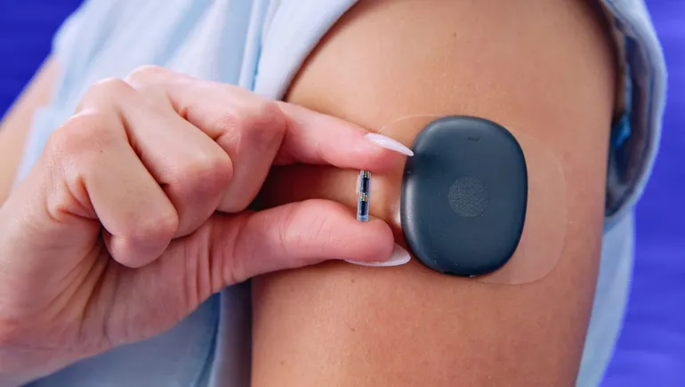 Senseonics تستكمل نقل مبيعات Eversense 365 إلى إدارة داخلية وتخطط لحساس مزروع بالكامل