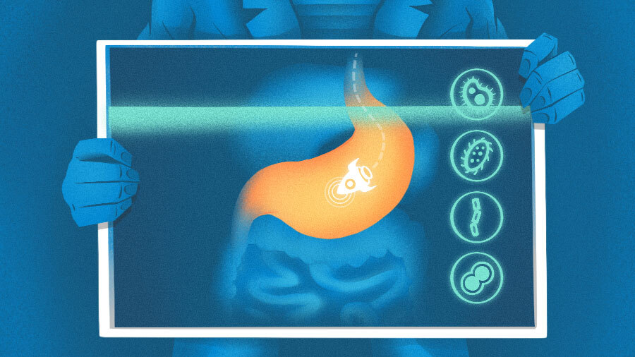 Tiny Health sammelt 33 Millionen Dollar zur Ausweitung häuslicher Darmmikrobiom-Tests