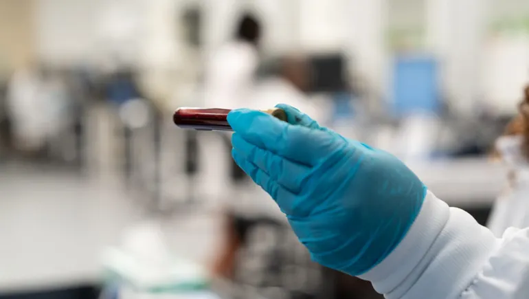 Un comité consultatif auprès de la FDA soutient le test de Grail pour détecter plusieurs cancers