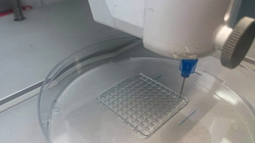 Turkish Researchers Develop a Bioprinted Microneedle Patch to Treat Melanoma
