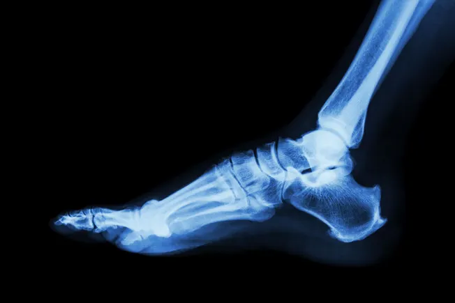 تليداين تتفق على الاستحواذ على Varex Imaging مقابل نحو 1.1 مليار دولار