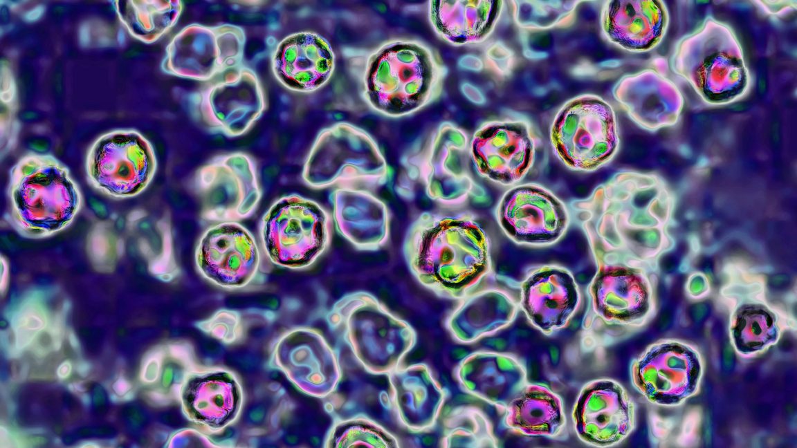 Genetic Sequencing Technologies Reveal Shift in US Measles Outbreak Risks from International to Domestic Travel